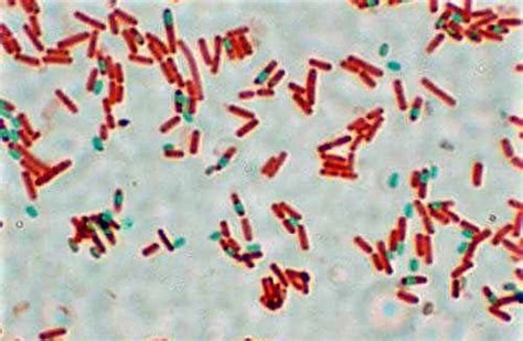 Endospore Staining .
